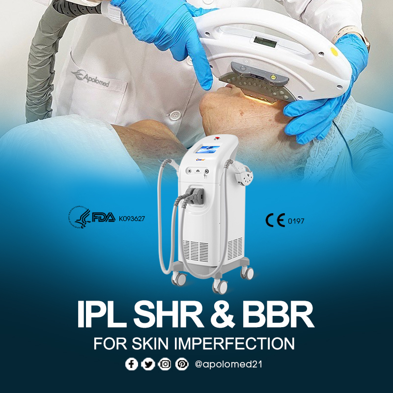 IPL SHR technology 660 3.9 Tecnología IPL SHR 660 3,9