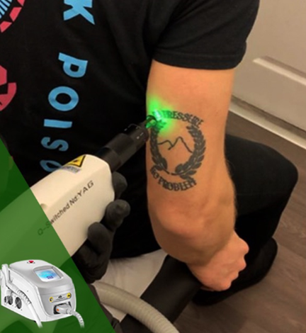 QS laser equipment 2 Equipo láser QS 2