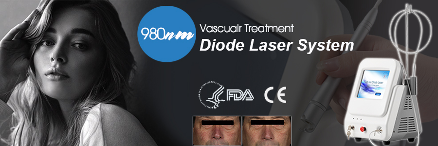 vascular removal 980nm diode laser device dispositivo láser de diodo de 980 nm para eliminación vascular