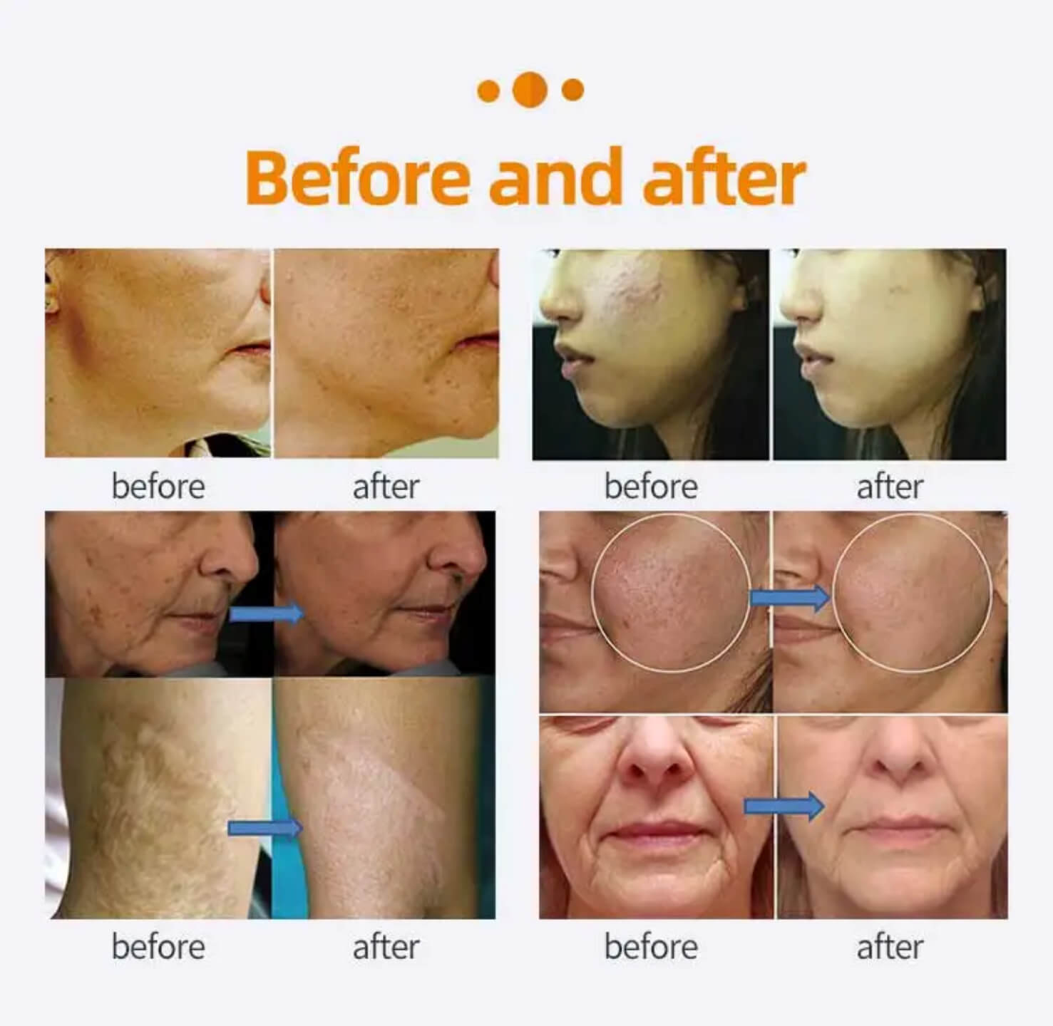 Before&After Antes y después