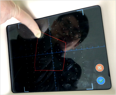 Pantalla l&aacute;ser C02 5
