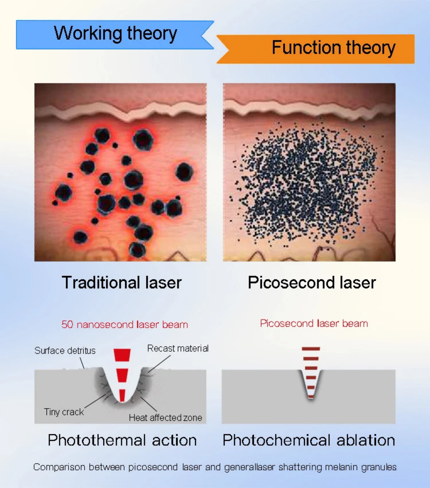 ¿Cuál es la ciencia detrás de la eliminación del tatuaje de láser?