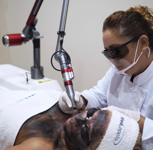 Sistema láser Nd Yag con conmutación Q