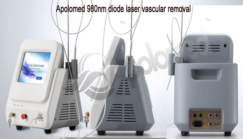 equipo de l&aacute;ser de diodo de 980 nm para eliminaci&oacute;n vascular